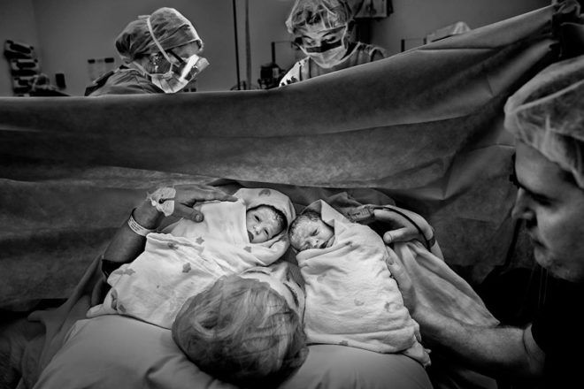 selena rollason birth photo caesarian