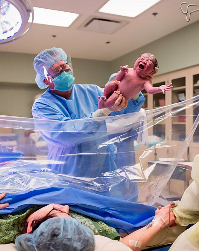 Clear Drape C Sections Allow Mums To Watch Baby Being Born