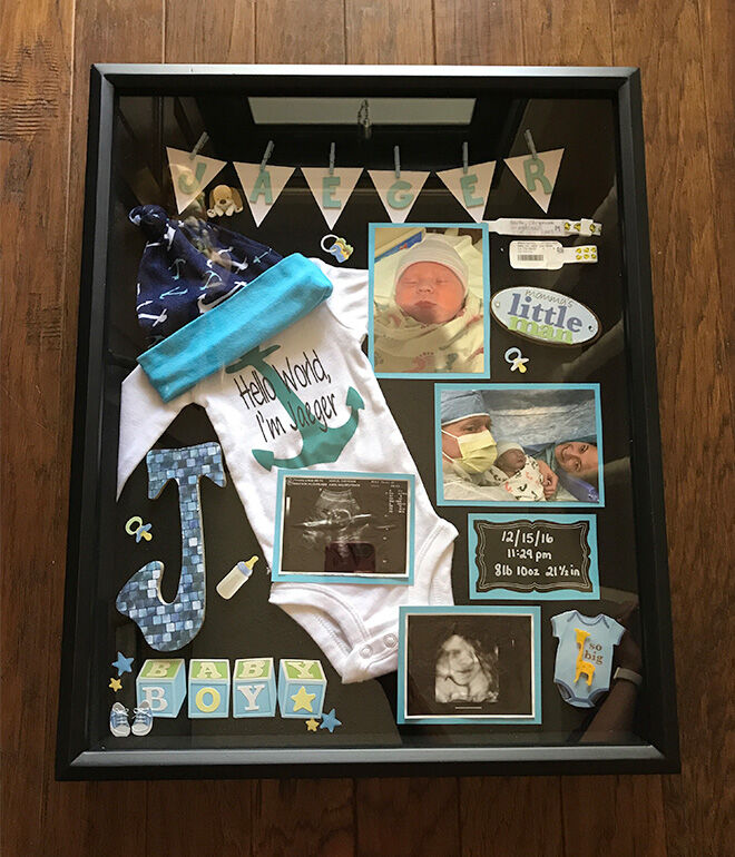 top 95+ Pictures creative ways to display ultrasound pictures Updated