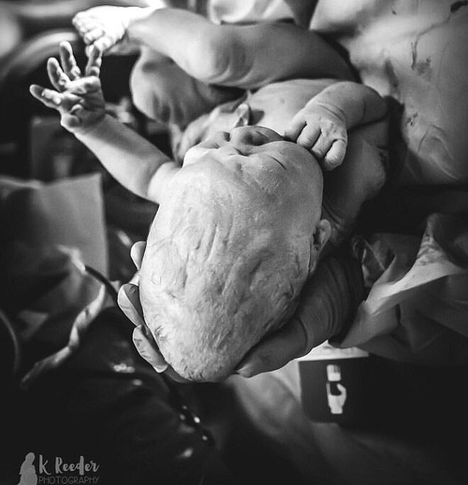 Revealed What happens to a baby's head during birth