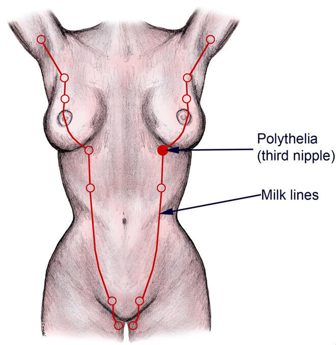 How a vulva can lactate