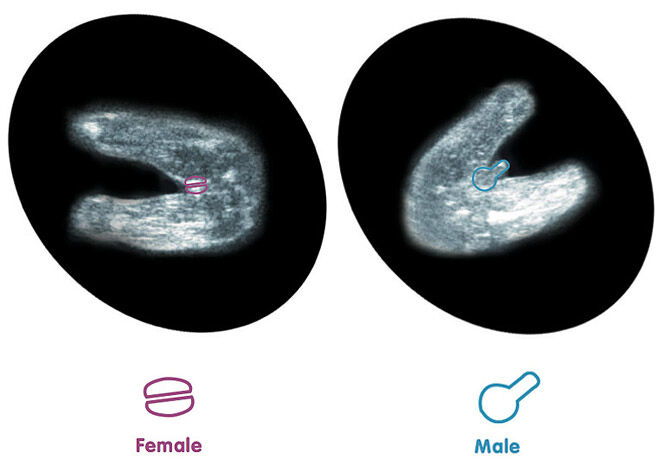 Gender detect when ultrasound can Blood Test