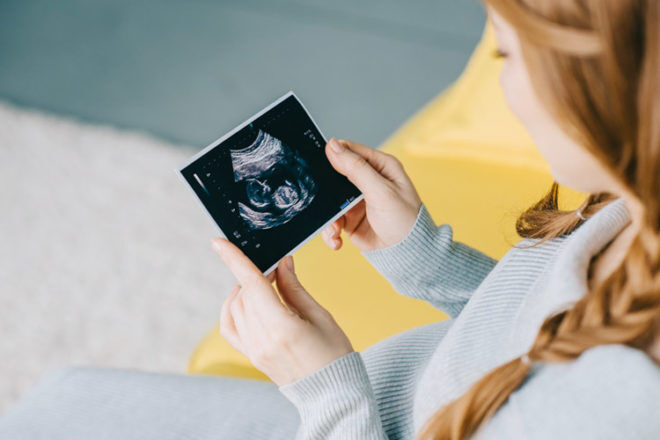 Tecken på att barnet är en pojke eller flicka från ett tidigt ultraljud | Mum's Grapevine