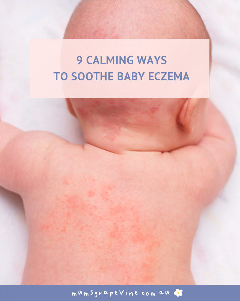 9 ways to soothe a baby with eczema Mum�s Grapevine