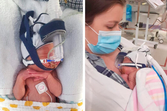 Real Australian birth story