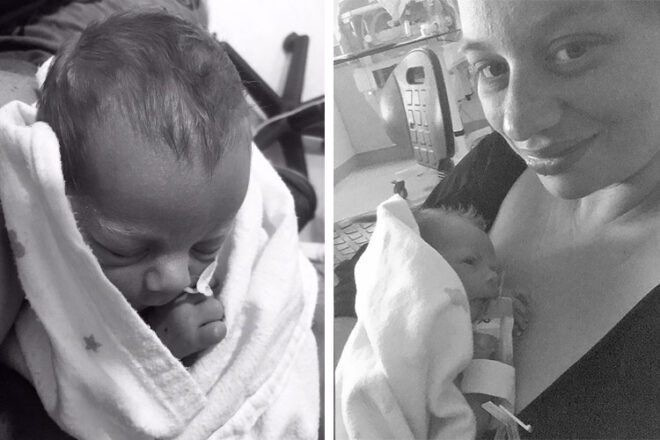 Breech birth story